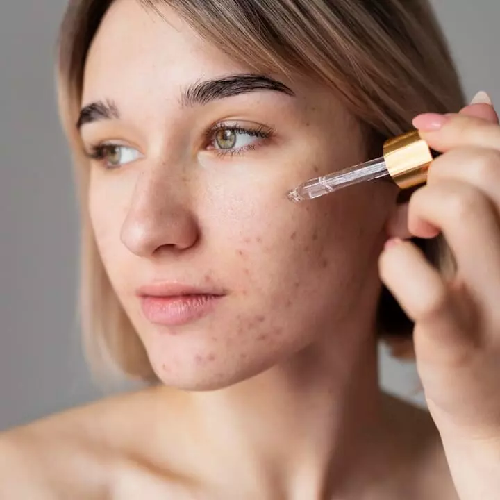 Antiacne
